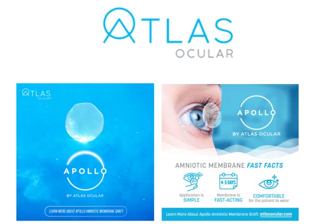 Atlas Ocular’s Bahram Alavi announces the launch of the revolutionary Apollo Amniotic Membrane Graft Technology, designed to enhance ocular healing through its anti-scarring, anti-inflammatory, and healing-promoting properties.